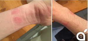 Labor-Analyse: So giftig ist die Apple Watch