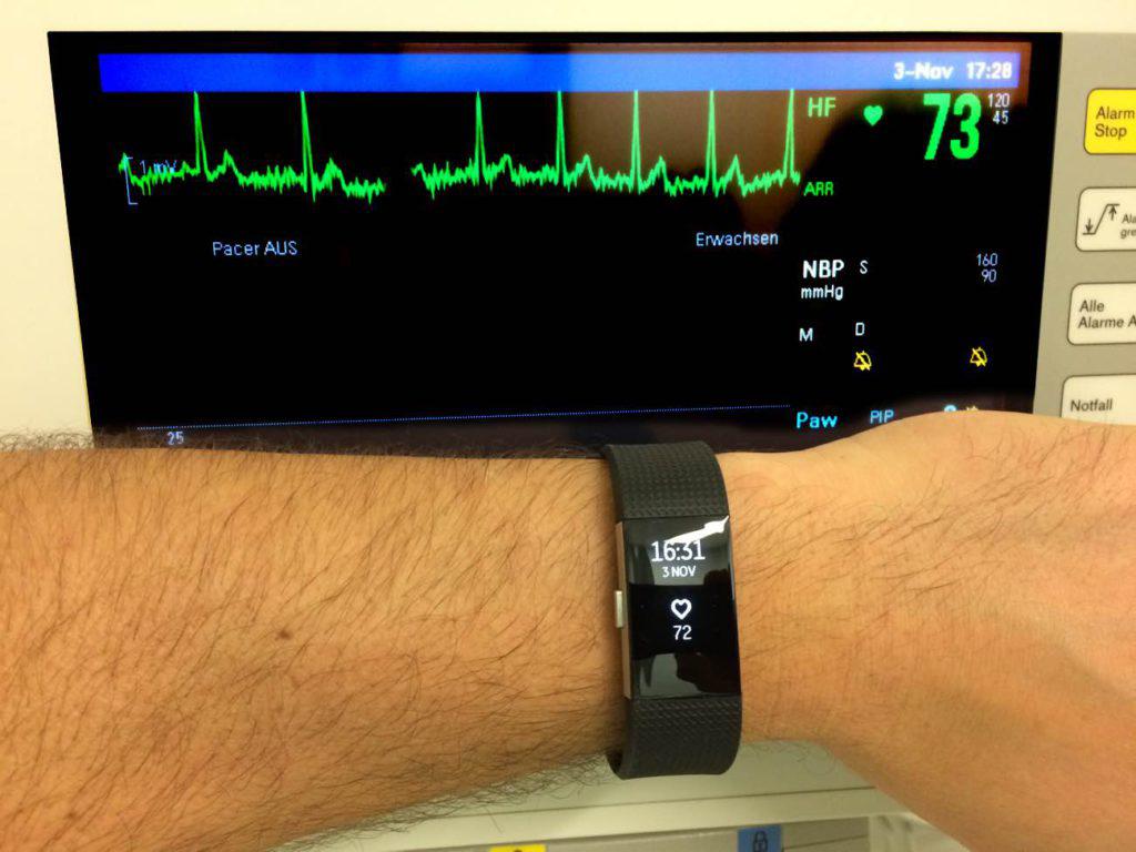 Fitbit Charge 2 Pulsmesser und EGK Vergleich