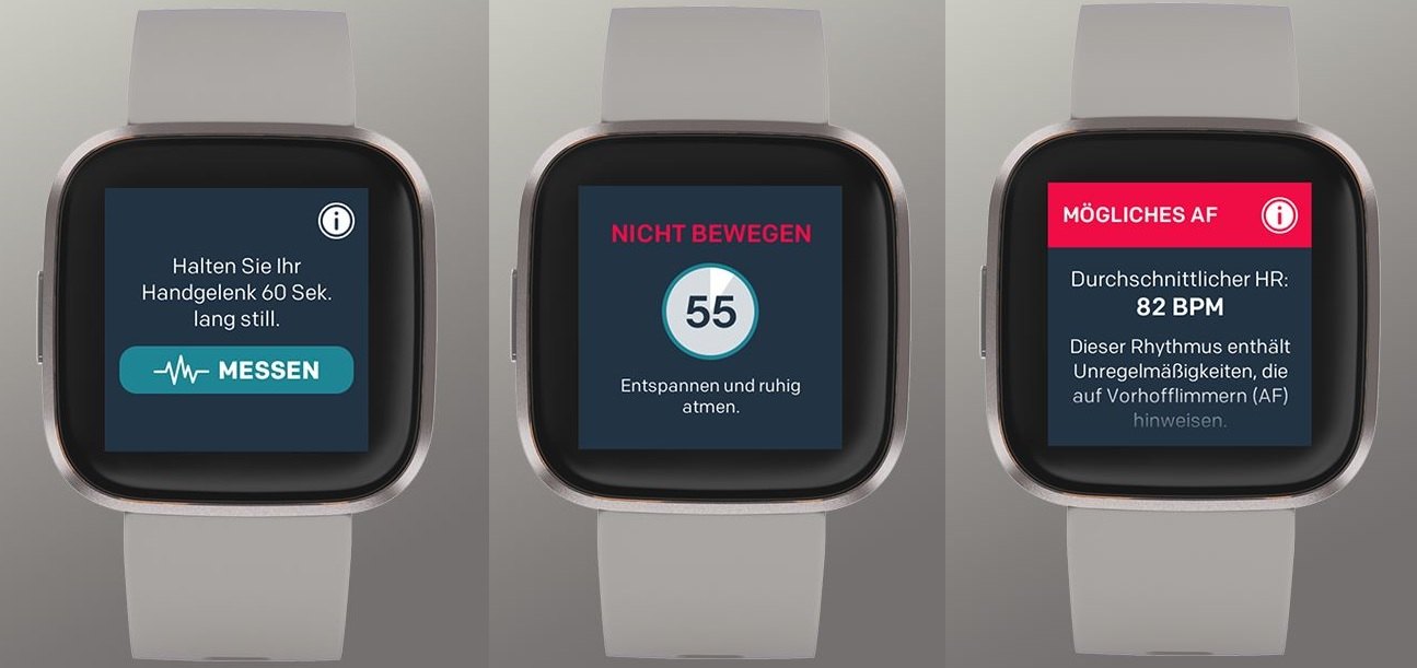 fitbit smartwatch fibricheck_1