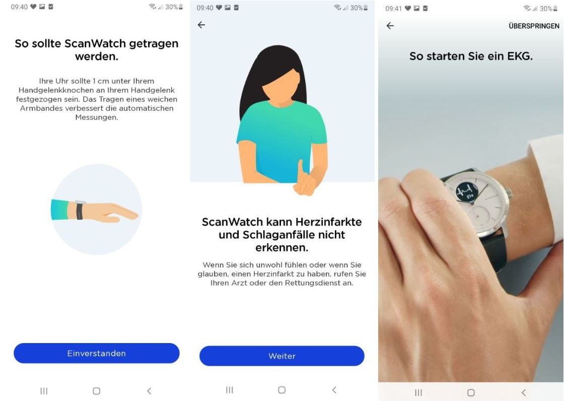 withings scanwatch smartwatch test hinweise gesundheit